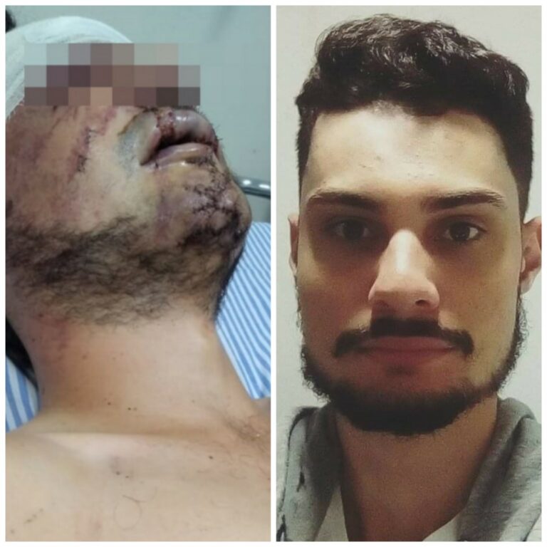 Homofobia e tentativa de homicídio no caso da agressão ao estudante