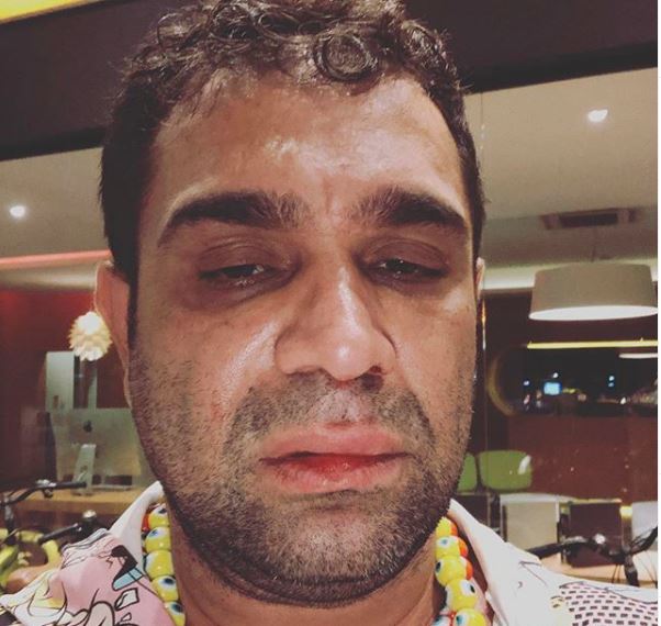 Ex-pânico na TV assume vício em drogas e pede ajuda