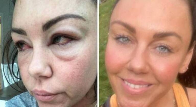 Cantora mostra ‘antes e depois’ de batalha contra o alcoolismo