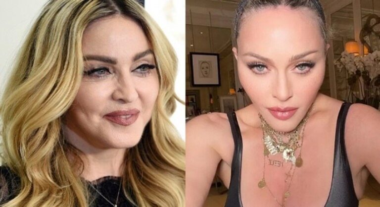 O que aconteceu com rosto de Madonna?