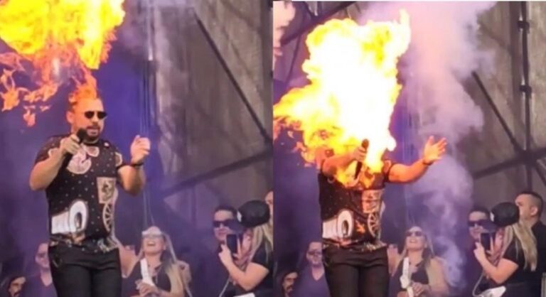 Cantor é atingido por labaredas durante show
