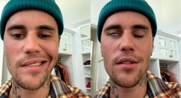 Justin Bieber aparece com metade do rosto paralisada