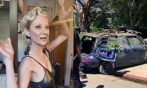 Anne Heche tem morte cerebral e terá aparelhos desligados