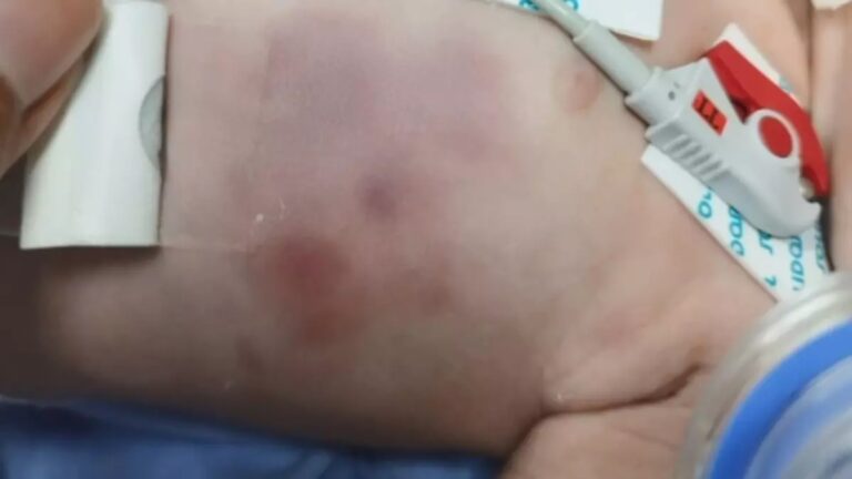 Justiça decreta e polícia prende casal suspeito de agredir bebê