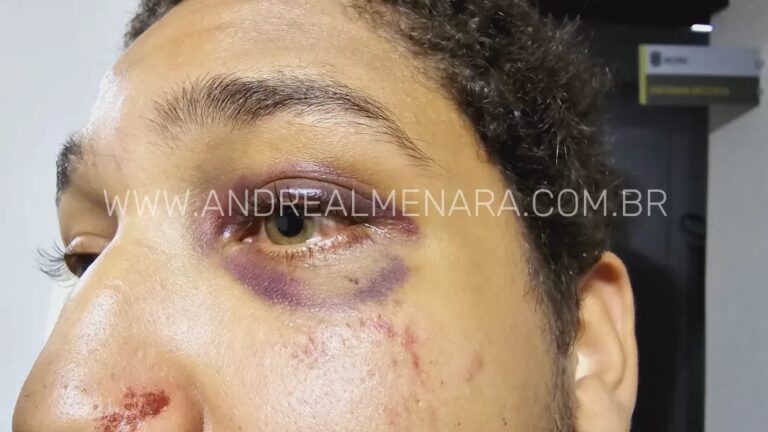 Rapaz que matou o irmão se apresenta, depõe e vai embora