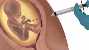 Abortos criminosos