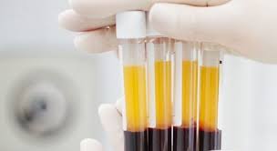 PEC que autoriza o comércio de plasma humano volta a ser discutida no Senado