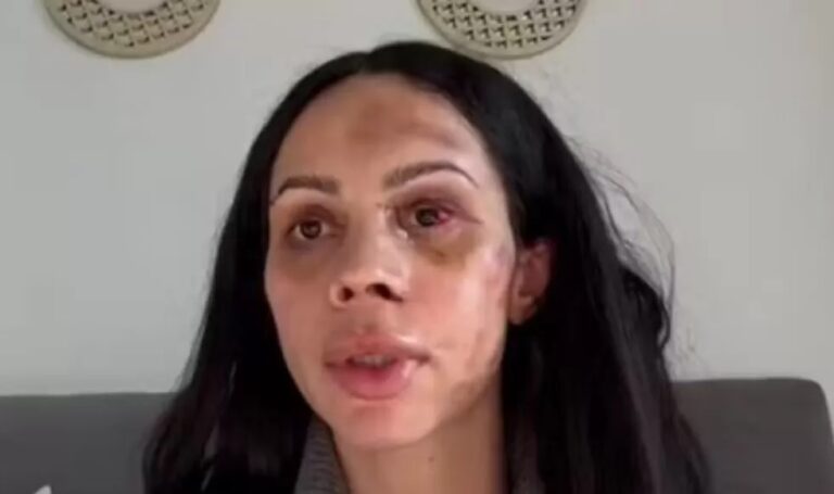 De alta, Maressa diz: “Quero me olhar com outros olhos”