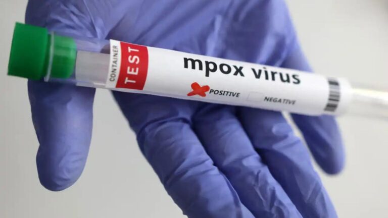 Maringá tem primeiro caso de mpox confirmado