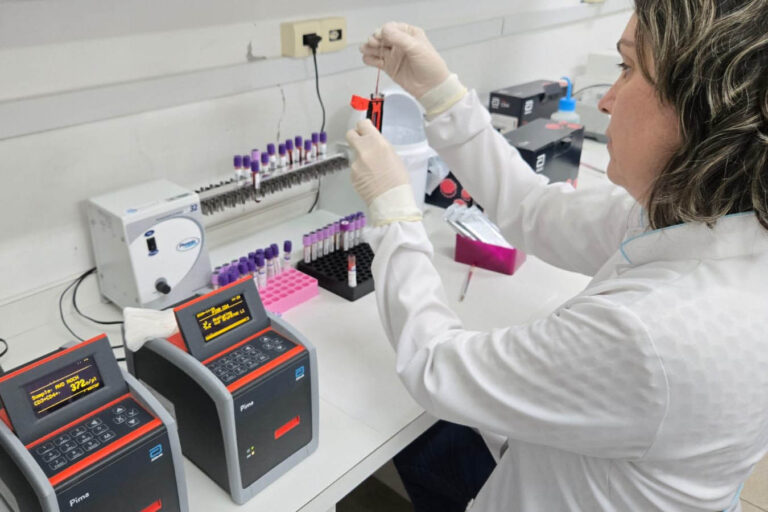 Lepac é referência nacional em diagnóstico de HIV