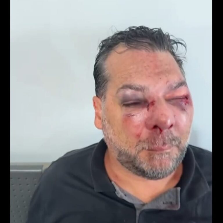 Homem é agredido brutalmente por ex-colega de trabalho
