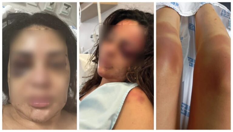 Médica de Maringá espancada em seu apartamento